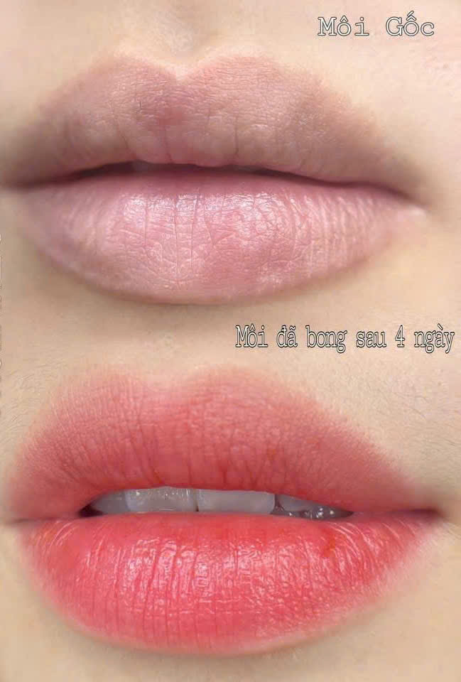 159308075115491175826