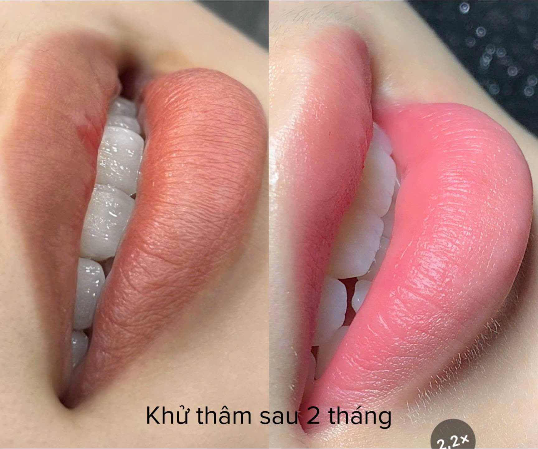 159308075115491175829