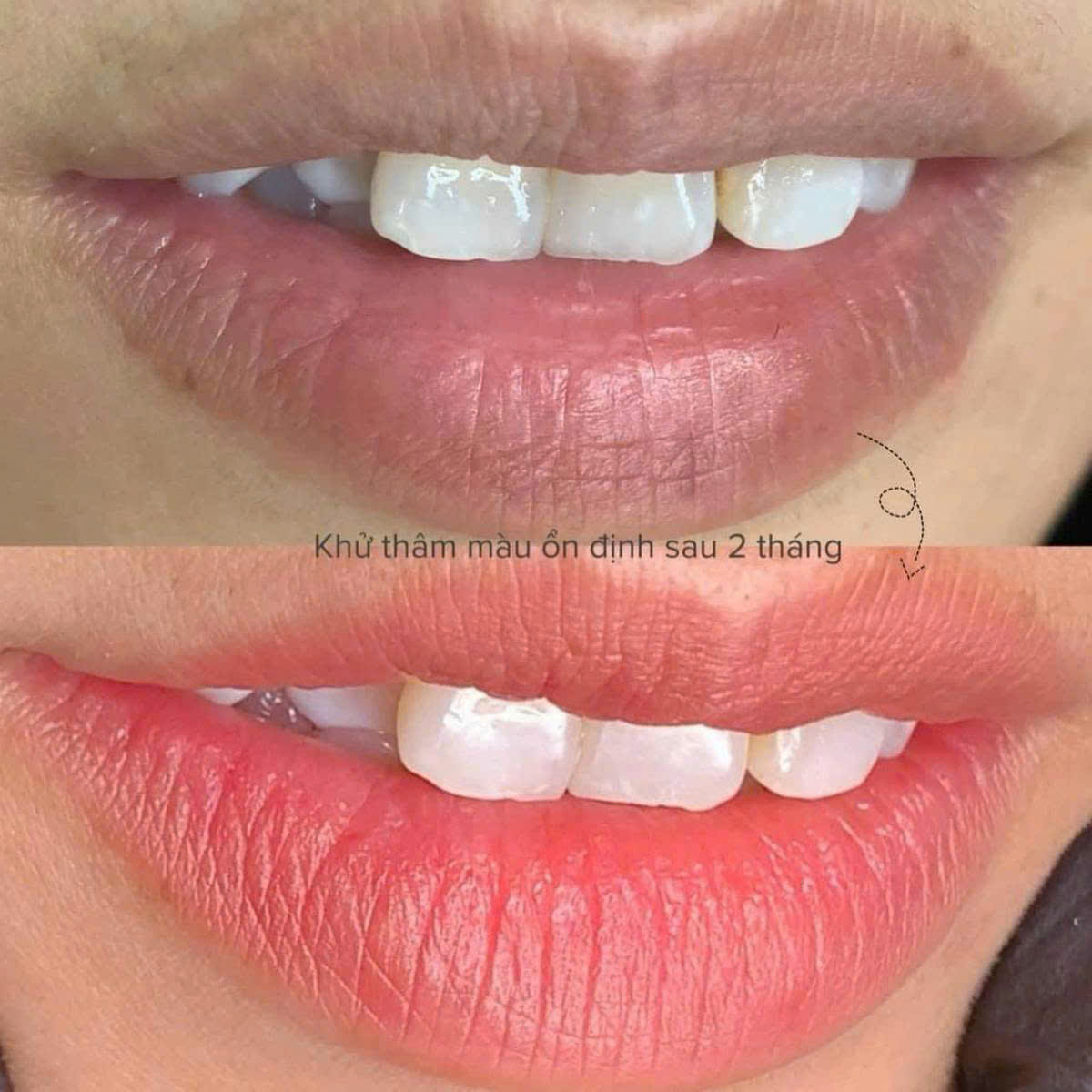 50620d23d0325e6c072334