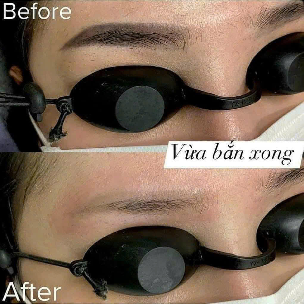 pwf2amf0gwaaazw5gvkuywyayxueyxmaaagjdq6